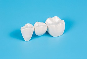 A closeup of a dental bridge set against a blue background