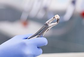 Close-up of hand holding forceps after tooth extraction