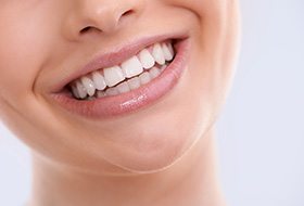 Close-up of woman’s beautiful smile after gummy smile correction