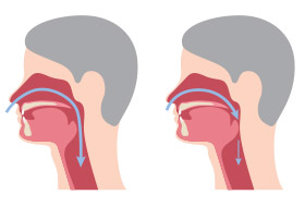Animation of open and obstructed airways