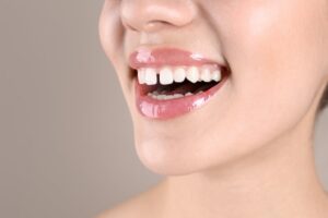 closeup of a smile with a gap between the front teeth